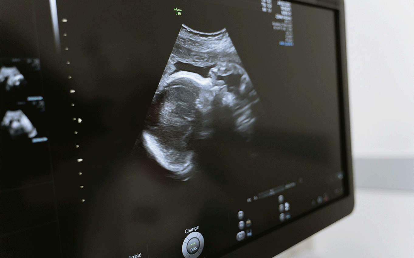 ecografia ecografia